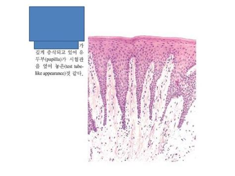 Embryology And Histology Oral Mucosa Flashcards Quizlet