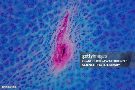 Hyaline Cartilage Connective Tissue Photos And Premium High Res