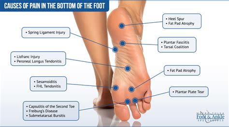 Foot Pain Chart | Metro Tulsa Foot & Ankle