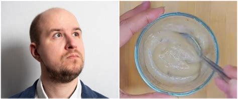 Tak Perlu Tonic Rosemary Tiktoker Ini Bagikan Cara Tumbuhkan Rambut