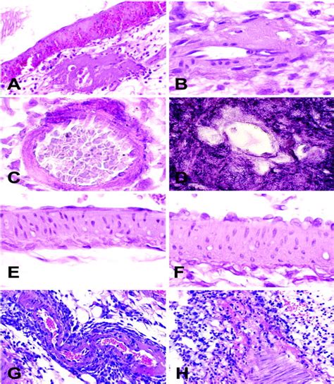 Histopathology Of Vascular Injury In Sprague Dawley Rats Treated With