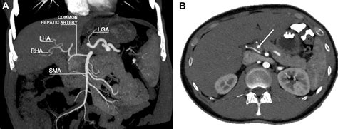 Liver Surgery Important Considerations For Pre And Postoperative