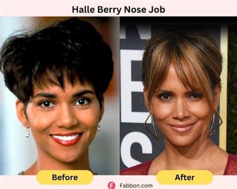 Most Coveted Celebrity Noses Updated Face Body Cosmetic Surgery