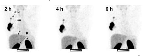 Figure From Affibody Pet Imaging Of Her Expressing Cancers As A Key