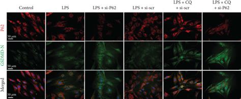 Dysfunction Of The Autophagy Lysosome Pathway Promoted The Accumulation