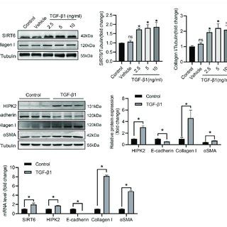 SIRT6 and HIPK2 are induced by TGF β1 in HK2 cells A Western blot