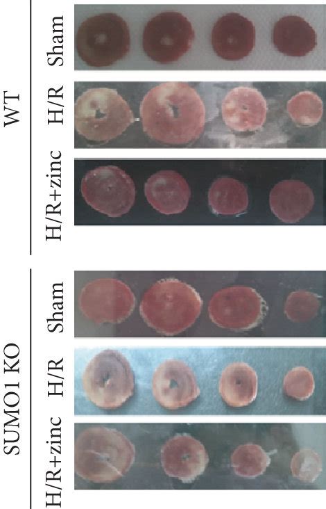 Effect Of Sumo On Zinc Preconditioning Mediated Myocardial Injury