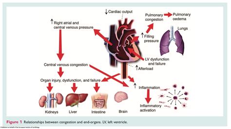 How To Calculate Cvp Medical