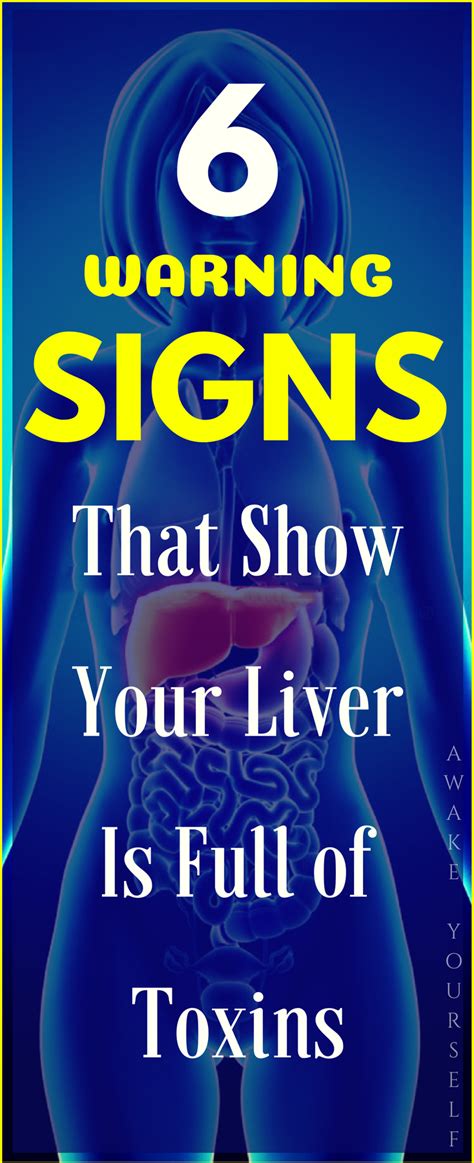 6 Warning Signs That Show Your Liver Is Full Of Toxins Dont Ignore