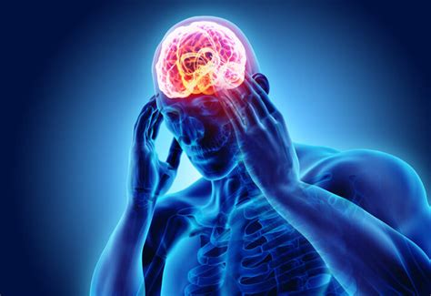 POST CONCUSSION HEADACHES Brain Injury Law Of Seattle