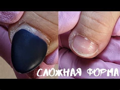НЕПРАВИЛЬНАЯ ФОРМА НОГТЕЙ. МАНИКЮР 2020 - YouTube | Широкие ногти ...