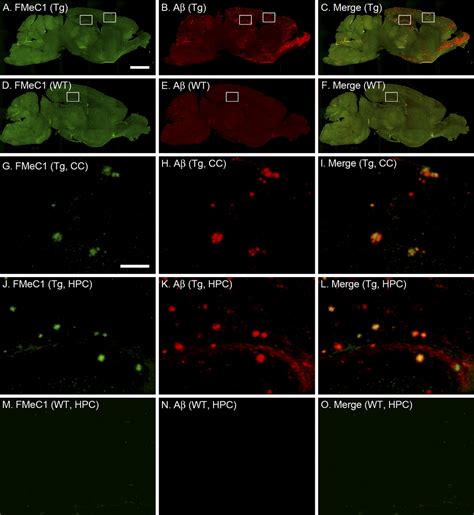 Figure 5 From In Vivo Detection Of Amyloid Deposition Using F Agnetic