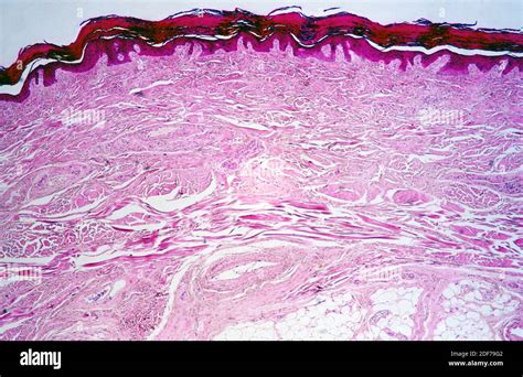 Epitelio Escamoso Estratificado No Queratinizado Fotos E Imágenes De