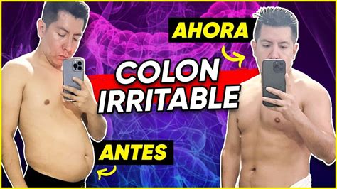 ASÍ ME CURÉ del SÍNDROME de INTESTINO IRRITABLE Mr Doctor YouTube