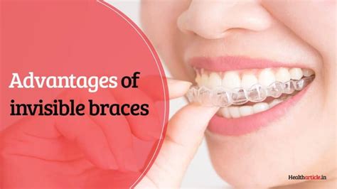 Invisible Braces Cost Advantages And Disadvantages