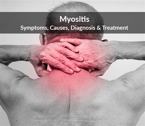 What Is Myositis Disease