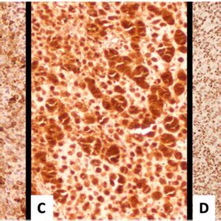 Immunohistochemical Positive Stain For Ae Ae A Desmin B