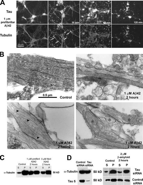 Tau Dependent Hypersensitivity Of Neuronal Microtubules To Prefibrillar