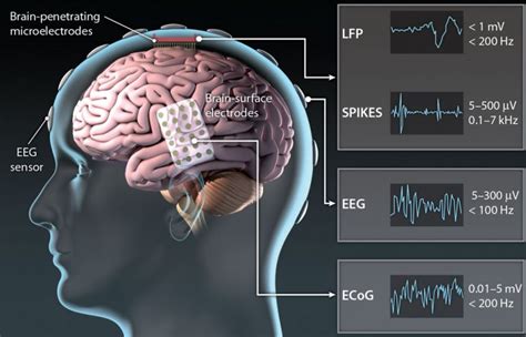 Il Cervello Diventa Smart Con La Prima Bci Wireless