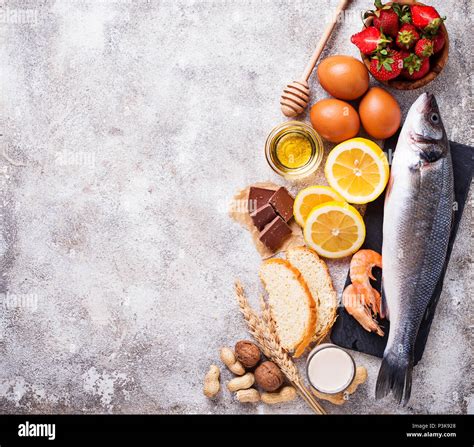 Allergy Food Concept Assorted Of Allergic Products Stock Photo Alamy