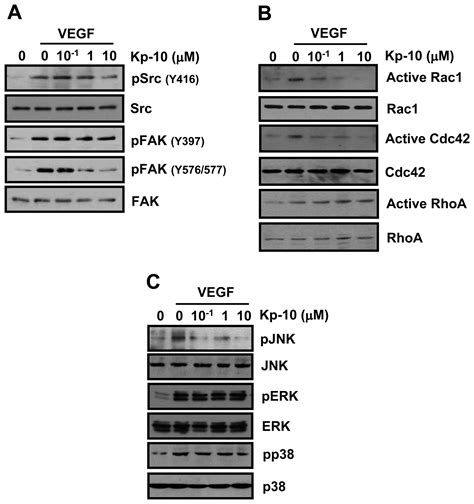 Kisspeptin 10 A KISS1 Derived Decapeptide Inhibits Tumor Angiogenesis