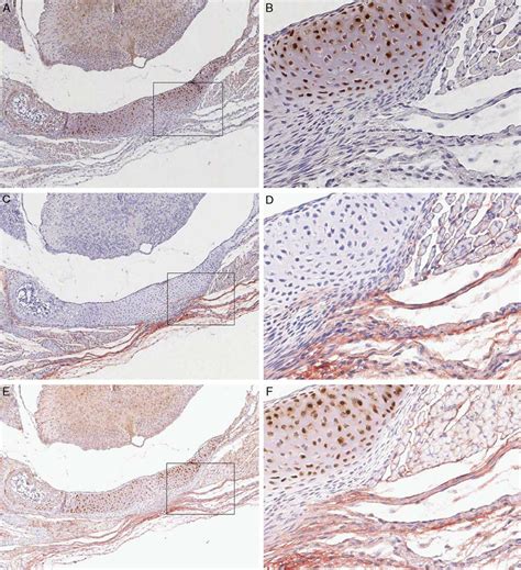 Experiment 2a Single Immunohistochemistry Protocol A And B With S100