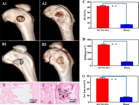 In Vivo Bone Regeneration Capacity Of AG NGHA Scaffold A B CT