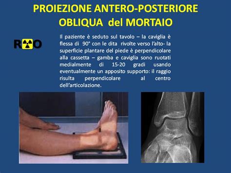 Lo Studio Radiografico Della Caviglia Radiologia Ortopedica