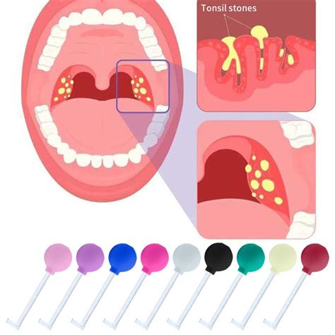 Tonsil Stone Remover Tool Manual Style Cleaner For Oral Care Red