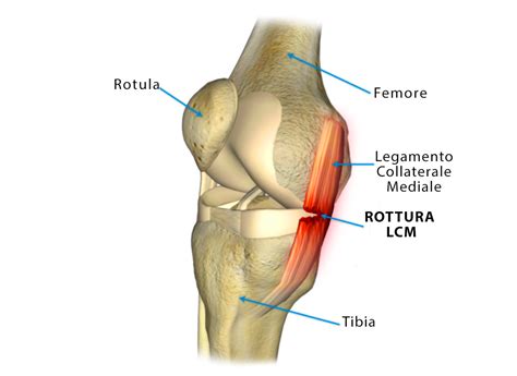 Patologie Del Ginocchio RC Therapy