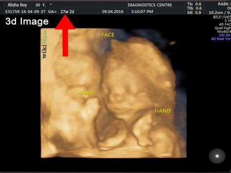 How To Read An Ultrasound Picture 9 Steps With Pictures