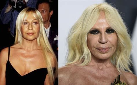 Donatella Versace Y Su Transformaci N Por Cirug As Fotos Chic Magazine