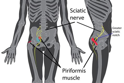 Inner Thigh Pain Healdove