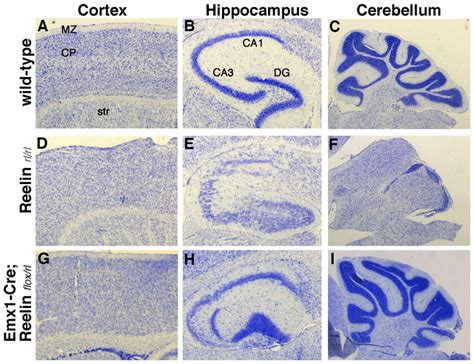 Histological Analysis Of Reelin Mutants Nissl Stained Sections Of