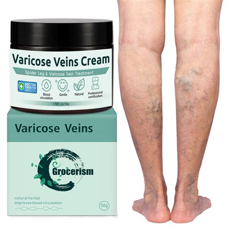 Crème Pour Les Varices 50g Varices Traitement Jambe Adaptée Aux Veines