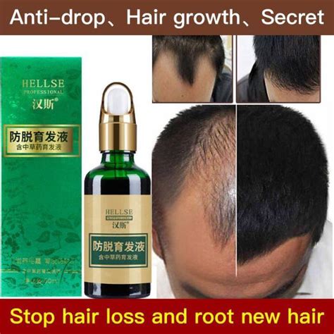 Chinese Herbal Hair Growth Serum Lazada Ph