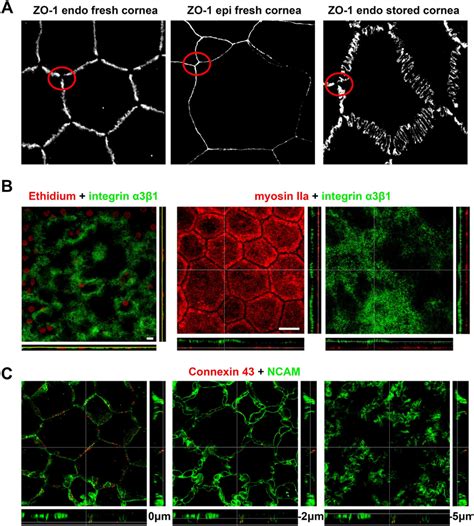 Additional Features Of Human Corneal Endothelial Cells Cecs A Download Scientific Diagram