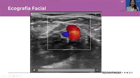 Webinar Ecograf A Facial Youtube