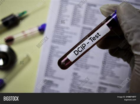 Dcip Test With Blood Sample Top View Isolated On Office Desk