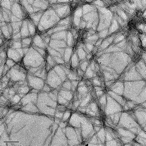 Image of the Week: Photoluminescent amyloid fibrils - Scope