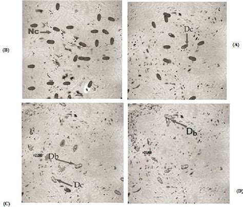 Transmission Electron Microscope Of E Coli Normal Vaginal Flora