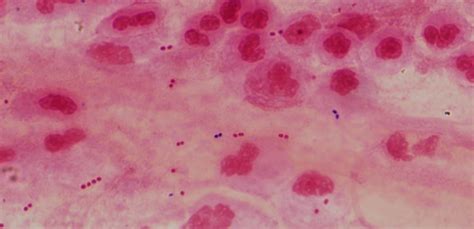 Bacterial Pneumonia Cell