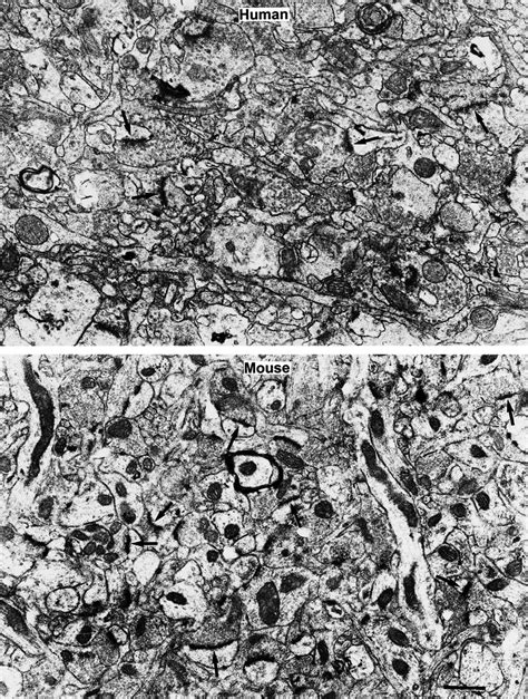 Electron Micrographs Illustrating The Thin Neuropil Of Layer IIIa In