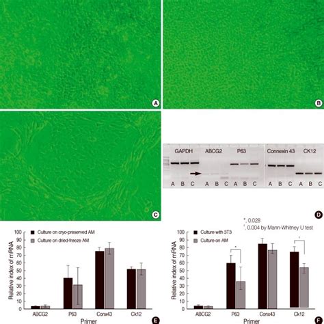 Cultivated Limbal Epithelial Cells On Amniotic Membranes AMs For 11