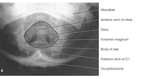 Ch 8 Images X Rays Cervical And Thoracic Spine Flashcards Quizlet