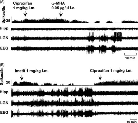 Two Examples Of Combined Actions Of An Ha H Receptor Antagonist And