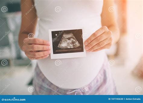 Pregnant Woman Holding Ultrasound Scan Concept Of Pregnancy Health