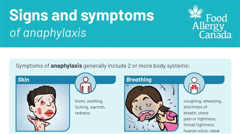 Anaphylaxis Resources Food Allergy Canada