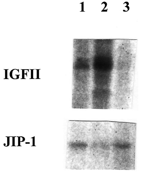 Figure 2 Expression Of Jnk Interacting Protein Jip 1 And Insulin