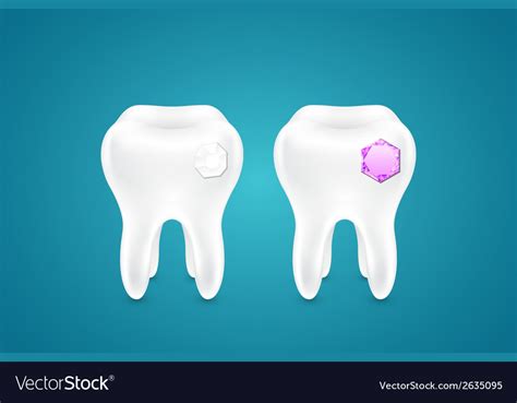 Diamonds in human teeth Royalty Free Vector Image